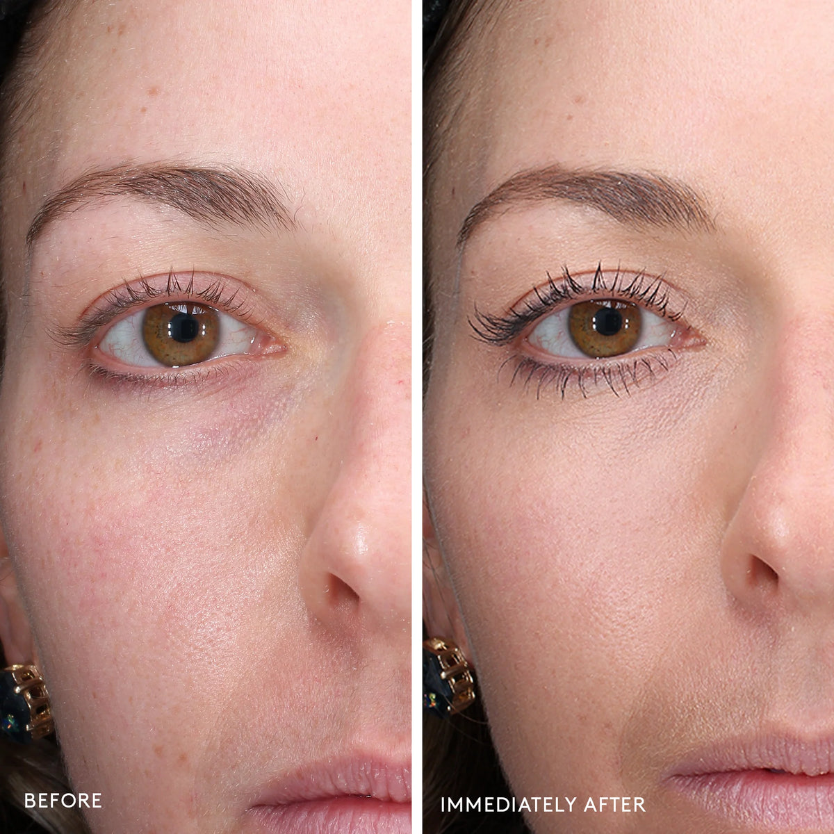 Total Eye ® Terapia de renovación 3 en 1 FPS 35